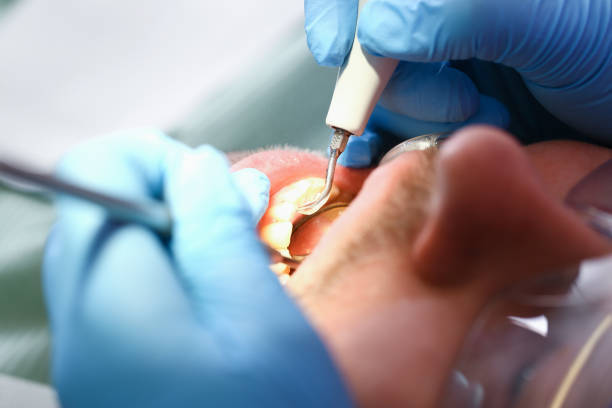 Best Mobile Emergency Dentist in Rossmoor, CA