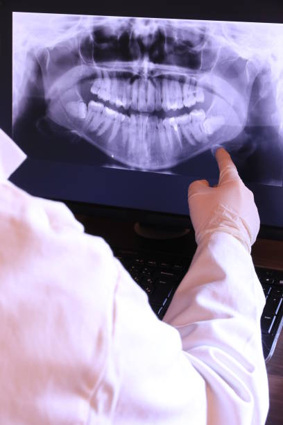 Best Weekend Emergency Dentist in Rossmoor, CA