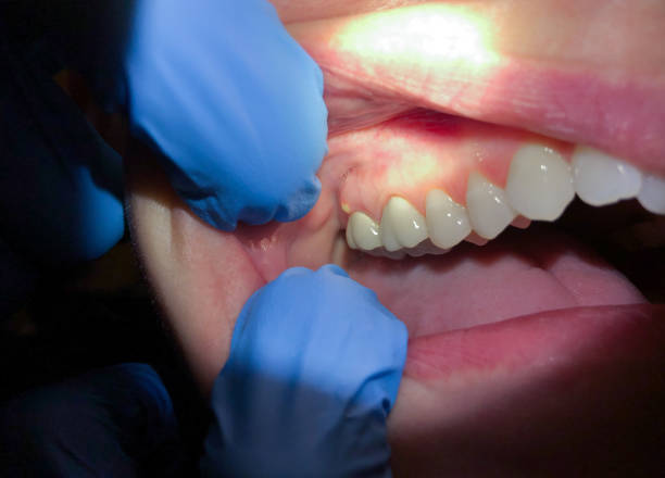 Best Emergency Cosmetic Dentistry in Rossmoor, CA